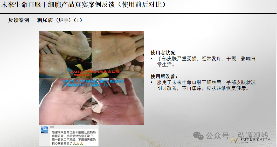 “Futurevita未来生命”:包装成海外健康项目,能治疗各种疾病?(2) “Futurevita未来生命”:包装成海外健康项目,能治疗各种疾病?(2)